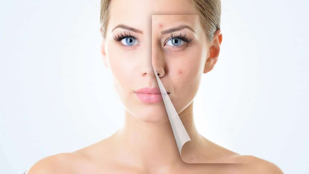 scar removal plastic surgery